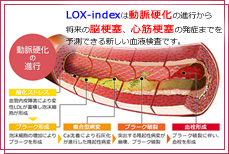 Lox-index 脳梗塞・心筋梗塞リスクチェック